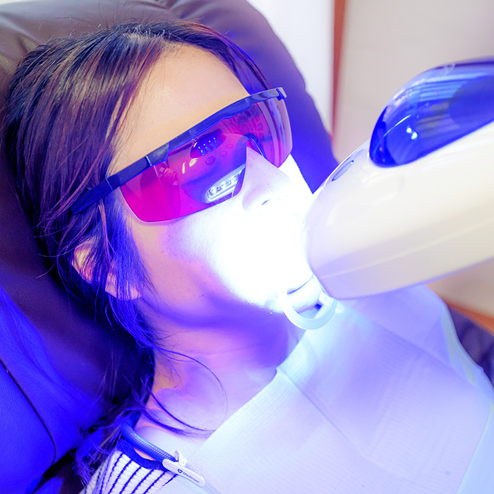 初心者の方にぴったりなホワイトニング