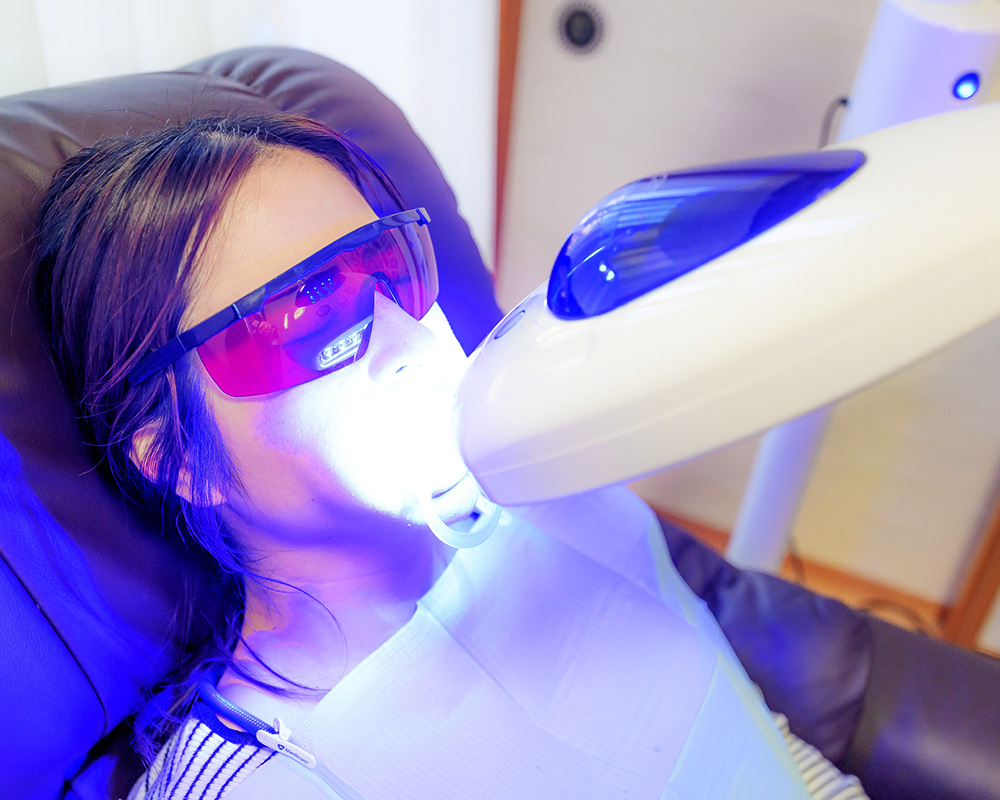 美歯口ホワイトニングのイメージ